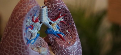 Oncologia pneumológica: Especialistas alertam para diminuição do número de primeiras consultas